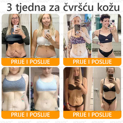 🎁 Preostalo je još samo 5 komada! Iskoristite dodatnih 50% popusta i pružite svojoj koži svakodnevnu njegu i ugodu uz APKAPK® kremu s pčelinjim otrovom! ✨