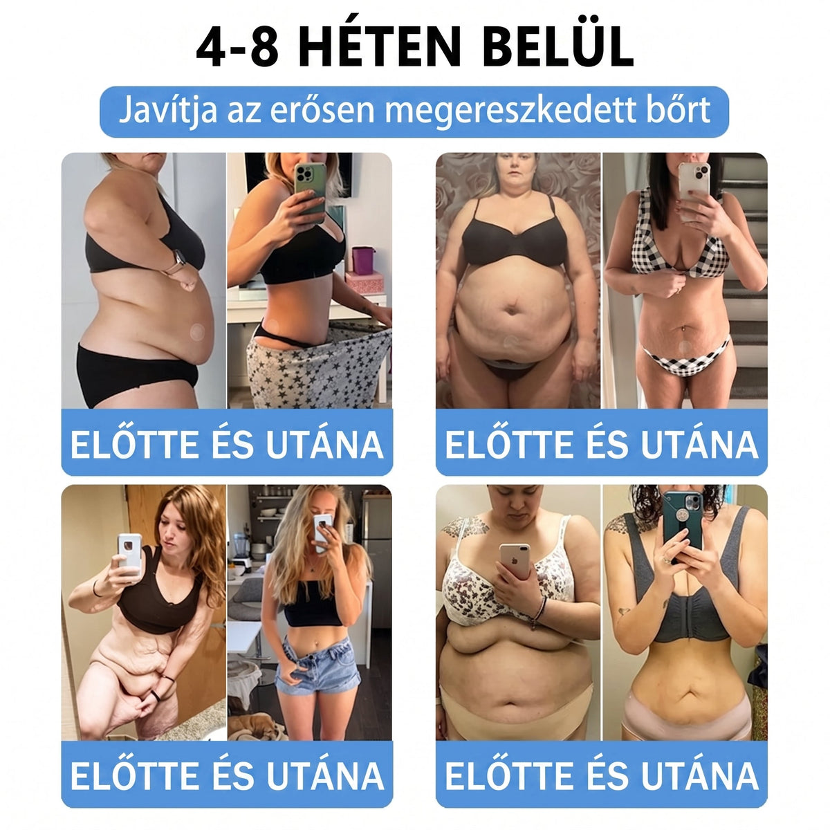 HIVATALOS WEBÁRUHÁZ | FFBSI® 0,27 mm-es Nano Mikrotűs METABOLIKUS Testsúlykezelő és Nyiroktámogató Tapasz