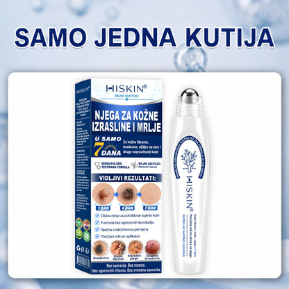 𝐇𝐈𝐒𝐊𝐈𝐍® 👩‍⚕️ 𝟕-𝐝𝐧𝐞𝐯𝐧𝐢 𝐭𝐫𝐞𝐭𝐦𝐚𝐧 𝐳𝐚 𝐮𝐤𝐥𝐚𝐧𝐣𝐚𝐧𝐣𝐞 𝐤𝐨ž𝐧𝐢𝐡 𝐢𝐳𝐫𝐚𝐬𝐥𝐢𝐧𝐚 𝐢 𝐦𝐫𝐥𝐣𝐚 – 𝐧𝐚𝐩𝐫𝐞𝐝𝐧𝐢 𝐩𝐫𝐞𝐜𝐢𝐳𝐧𝐢 𝐫𝐨𝐥𝐥-𝐨𝐧 𝐚𝐩𝐥𝐢𝐤𝐚𝐭𝐨𝐫 𝐳𝐚 𝐮𝐤𝐥𝐚𝐧𝐣𝐚𝐧𝐣𝐞 𝐤𝐨ž𝐧𝐢𝐡 𝐧𝐞𝐩𝐫𝐚𝐯𝐢𝐥𝐧𝐨𝐬𝐭𝐢, 𝐛𝐞𝐳 𝐛𝐨𝐥𝐢 𝐢 𝐨ž𝐢𝐥𝐣𝐚𝐤𝐚.