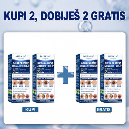 𝐇𝐈𝐒𝐊𝐈𝐍® 👩‍⚕️ 𝟕-𝐝𝐧𝐞𝐯𝐧𝐢 𝐭𝐫𝐞𝐭𝐦𝐚𝐧 𝐳𝐚 𝐮𝐤𝐥𝐚𝐧𝐣𝐚𝐧𝐣𝐞 𝐤𝐨ž𝐧𝐢𝐡 𝐢𝐳𝐫𝐚𝐬𝐥𝐢𝐧𝐚 𝐢 𝐦𝐫𝐥𝐣𝐚 – 𝐧𝐚𝐩𝐫𝐞𝐝𝐧𝐢 𝐩𝐫𝐞𝐜𝐢𝐳𝐧𝐢 𝐫𝐨𝐥𝐥-𝐨𝐧 𝐚𝐩𝐥𝐢𝐤𝐚𝐭𝐨𝐫 𝐳𝐚 𝐮𝐤𝐥𝐚𝐧𝐣𝐚𝐧𝐣𝐞 𝐤𝐨ž𝐧𝐢𝐡 𝐧𝐞𝐩𝐫𝐚𝐯𝐢𝐥𝐧𝐨𝐬𝐭𝐢, 𝐛𝐞𝐳 𝐛𝐨𝐥𝐢 𝐢 𝐨ž𝐢𝐥𝐣𝐚𝐤𝐚.