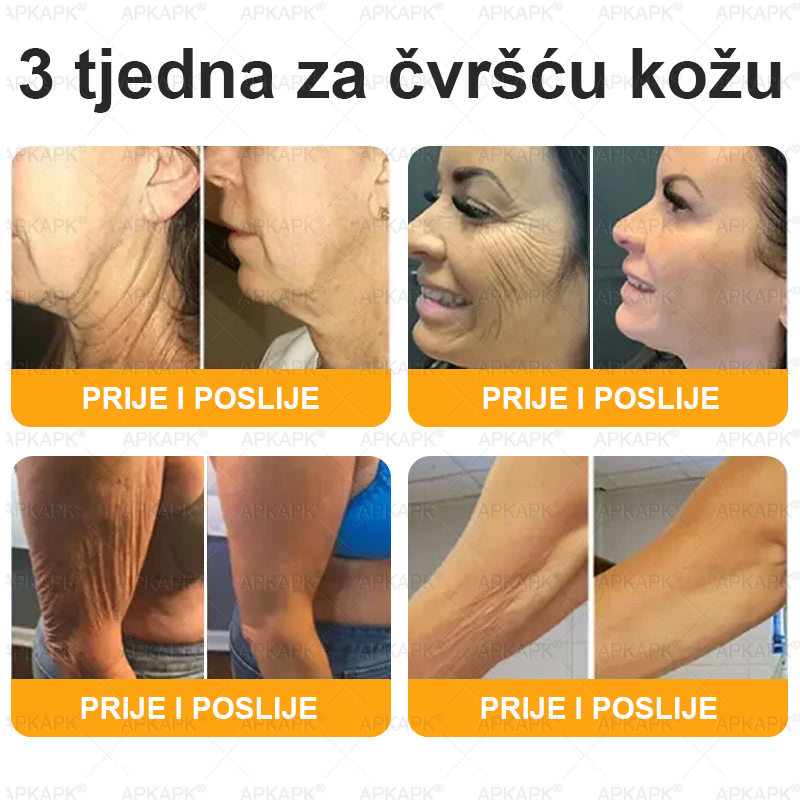 🎁 Preostalo je još samo 5 komada! Iskoristite dodatnih 50% popusta i pružite svojoj koži svakodnevnu njegu i ugodu uz APKAPK® kremu s pčelinjim otrovom! ✨
