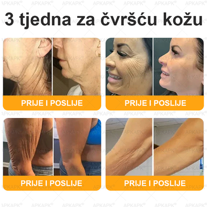 🎁 Preostalo je još samo 5 komada! Iskoristite dodatnih 50% popusta i pružite svojoj koži svakodnevnu njegu i ugodu uz APKAPK® kremu s pčelinjim otrovom! ✨
