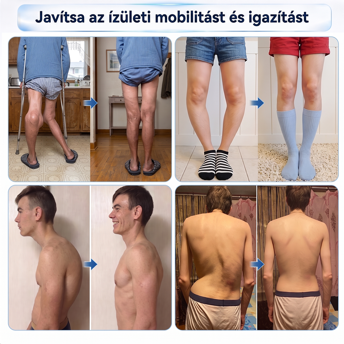 🎁 Már csak 5 darab maradt! Szerezzen most extra 50% kedvezményt, és támogassa ízületei mindennapi komfortját a DR.HONOR® mikrotűs Roll-Onnal! 🦴✨