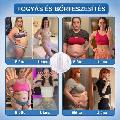 HIVATALOS WEBÁRUHÁZ | FFBSI® 0,27 mm-es Nano Mikrotűs METABOLIKUS Testsúlykezelő és Nyiroktámogató Tapasz