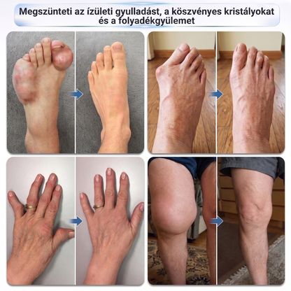 🎁 Már csak 5 darab maradt! Szerezzen most extra 50% kedvezményt, és támogassa ízületei mindennapi komfortját a DR.HONOR® mikrotűs Roll-Onnal! 🦴✨