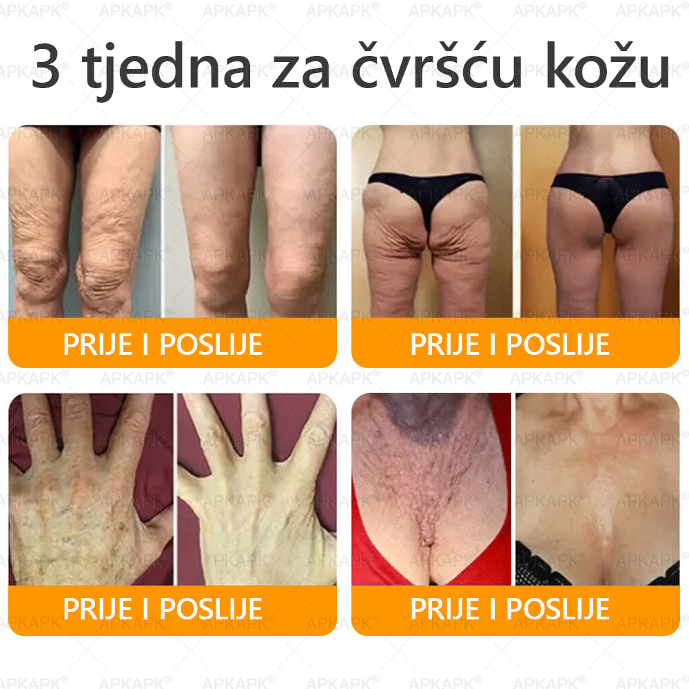 🎁 Preostalo je još samo 5 komada! Iskoristite dodatnih 50% popusta i pružite svojoj koži svakodnevnu njegu i ugodu uz APKAPK® kremu s pčelinjim otrovom! ✨