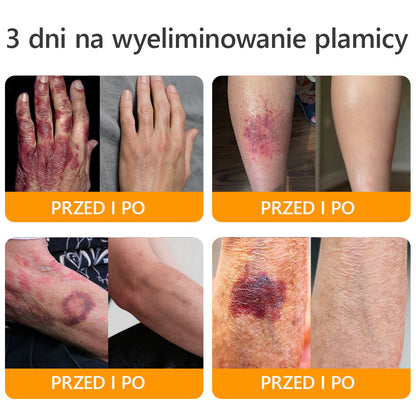 ΑPΚΑPK™ Jad Pszczoły Kompleksowy Krem🥇pomaga w leczeniu problemów skórnych, takich jak: zmarszczki, blizny, plamy pigmentacyjne, rozstępy, trądzik, łuszczyca, egzema, zmiany skórne, podrażnienia, stany zapalne i inne problemy skórne🔥